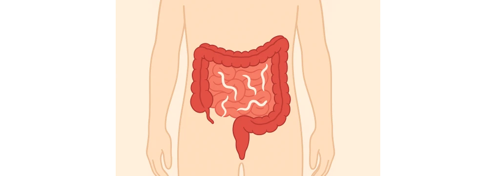 Vermi intestinali: cosa fare, sintomi, cause e rimedi