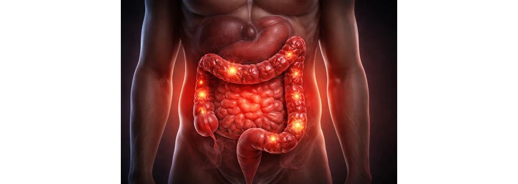 Colite: sintomi, dolore, disturbi nei bambini e quando preoccuparsi