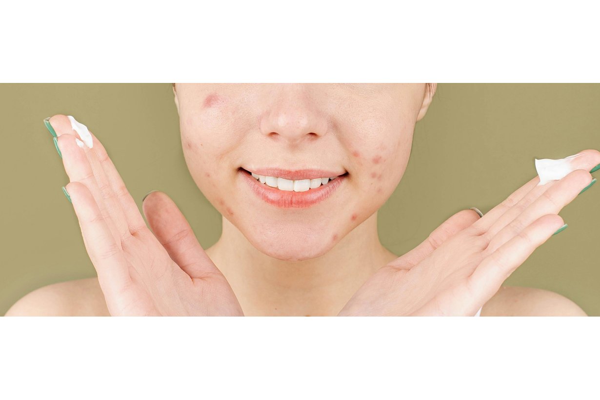 Guida Completa all'Uso della Crema Benzac per Trattare i Brufoli