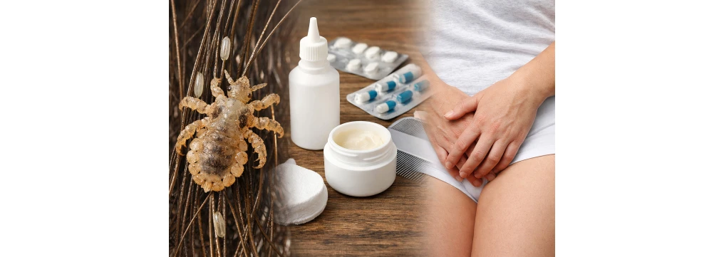 Piattole: come capire se le hai, come eliminarle e perché vengono