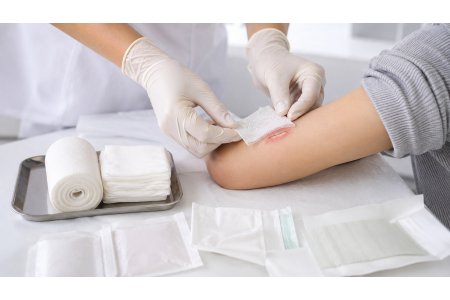 Jelonet, Grassolind, Eurospital Non Ad e Bactigras: differenze tra garze paraffinate e garze con clorexidina Jelonet, Grassolind, Eurospital Non Ad e Bactigras: differenze tra garze paraffinate e garze con clorexidina