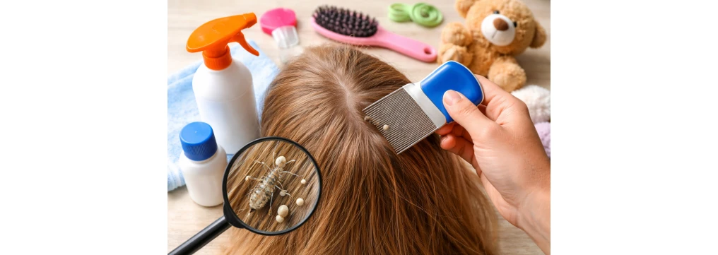 Pidocchi: come riconoscerli, eliminarli subito e prevenirli | Guida Completa