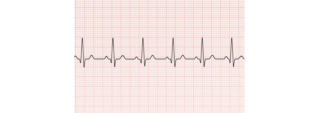 Frequenza Cardiaca Ideale: Tutto Quello che Devi Sapere sui Battiti al Minuto