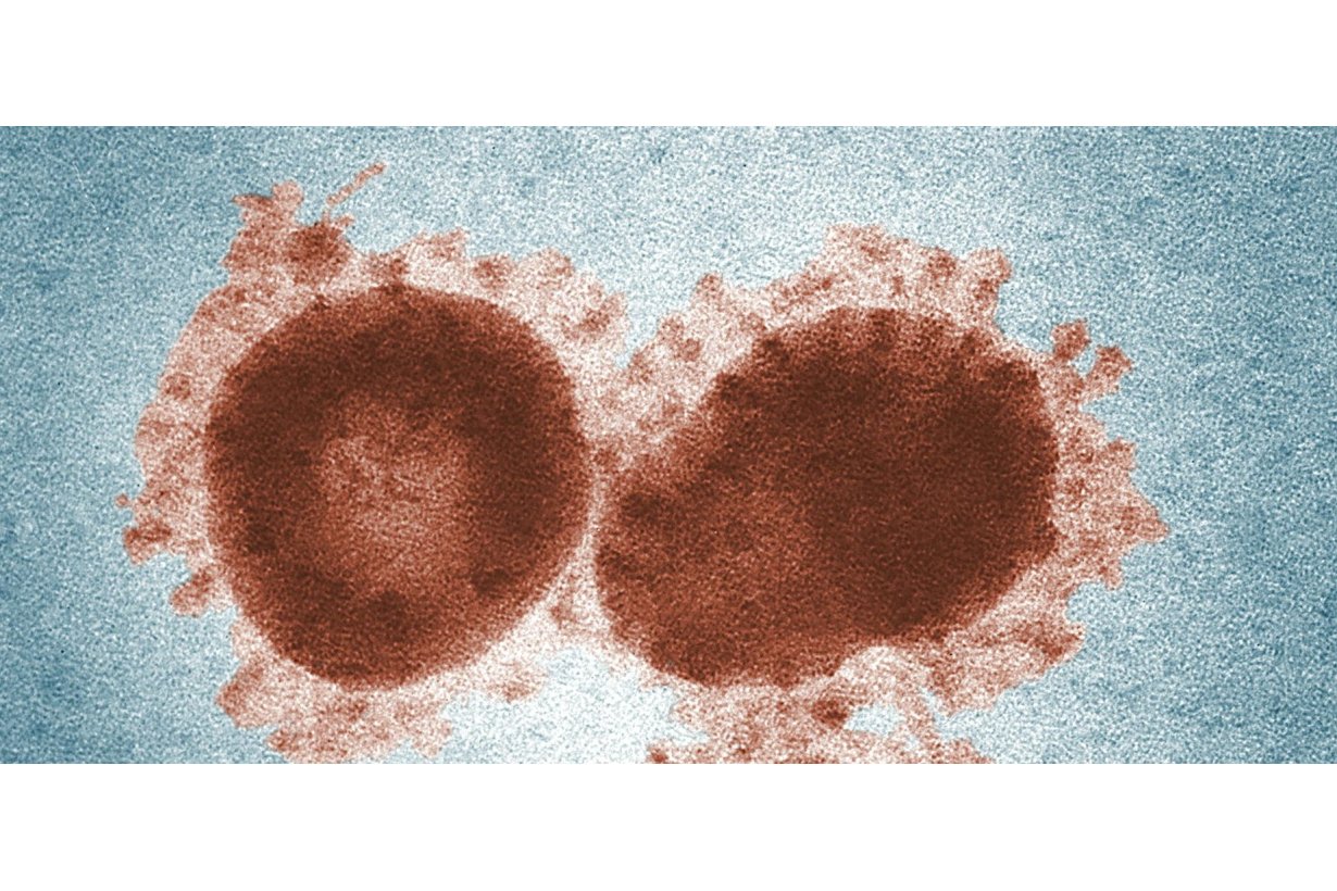 Hantavirus: Cos'è, Come si Prende e Come Prevenirlo