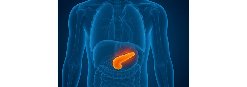 Tumore neuroendocrino al pancreas: sintomi, stadi e aspettativa di vita