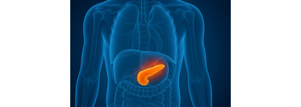Tumore neuroendocrino al pancreas: sintomi, stadi e aspettativa di vita