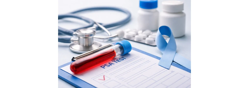 Valori PSA: quando preoccuparsi, PSA a 70 anni, PSA free e calcolo del PSA totale