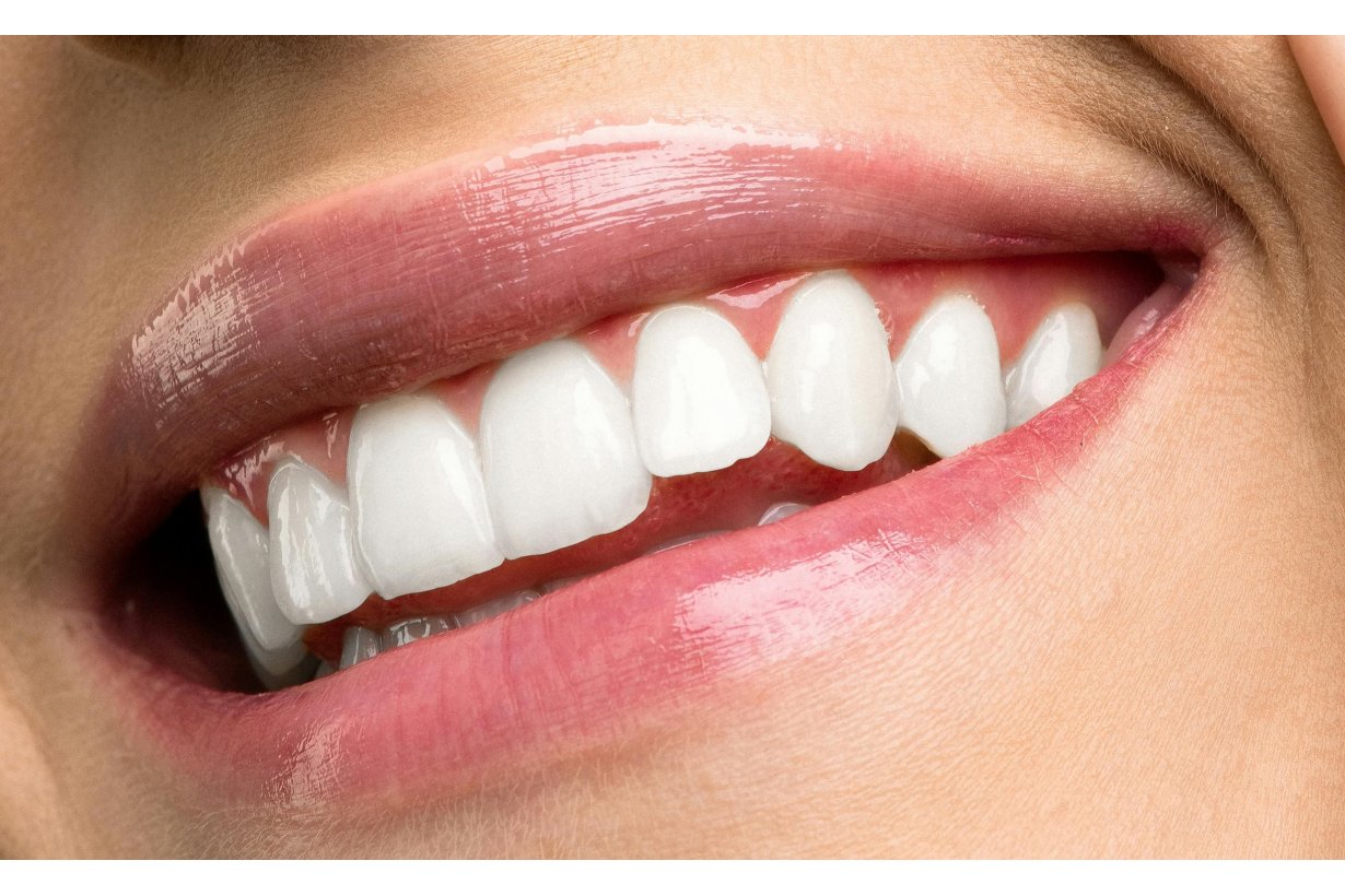 Trattamenti Efficaci per Labbra Secche e Screpolate: La Roche-Posay, Nuxe, Labello e Molti Altri