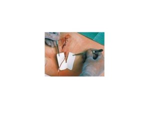 Metalline Drain  6 X 7 Cm  50 Pezzi