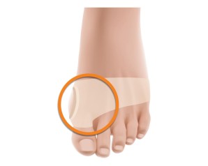 FASCIA PROT ALLUCE VALGO GEL M