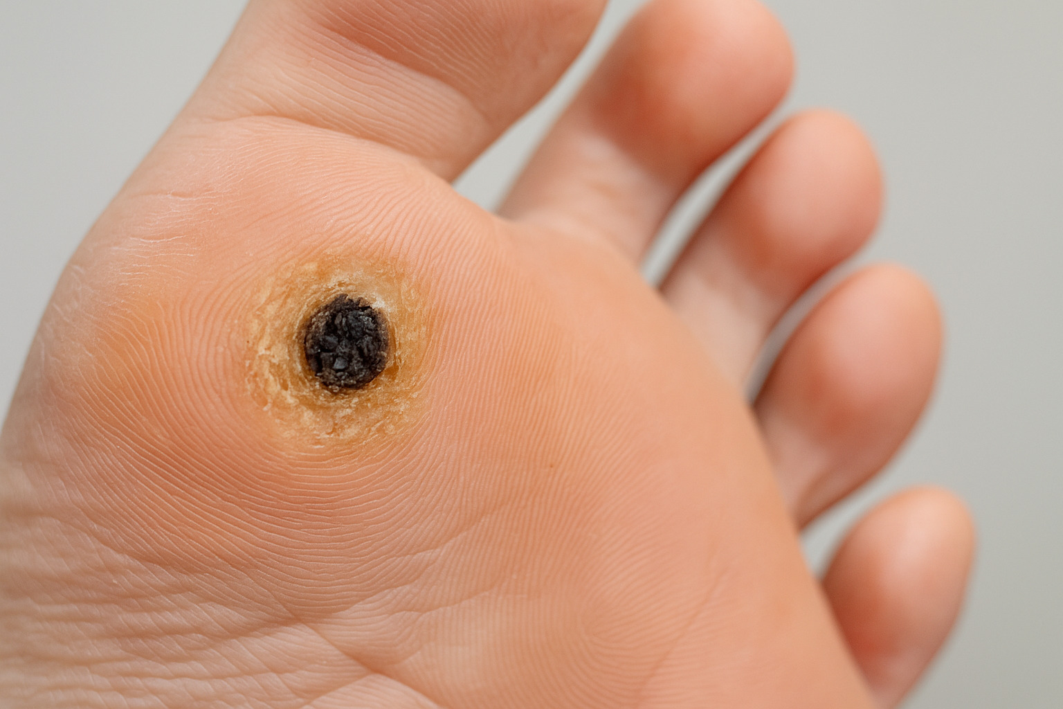 geekvape aegis solo 3 istruzioni Crioterapia dermatologica Milano, una terapia estremamente utile Milano